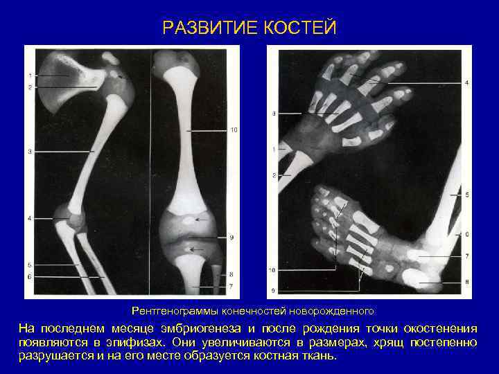 Рассмотрите рентгенограмму с изображением кисти человека как