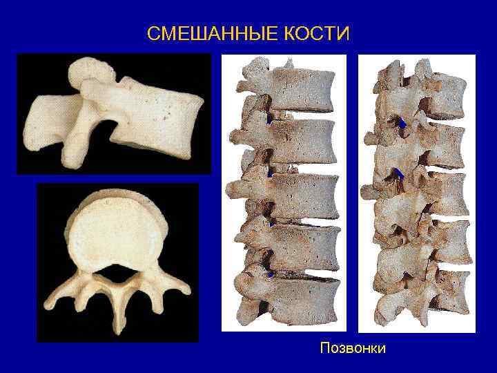 Что такое кость. Смешанные кости позвонки. Позвонок смешанная кость. Строение смешанных костей. Кость позвонка строение.