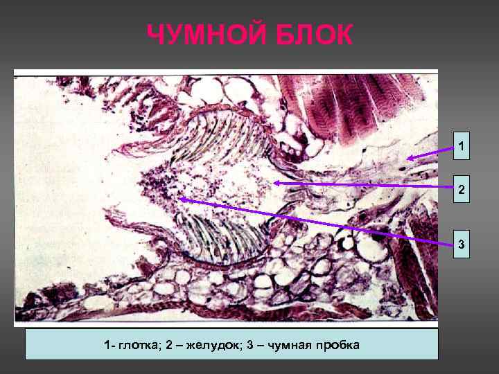 ЧУМНОЙ БЛОК 1 2 3 1 - глотка; 2 – желудок; 3 – чумная