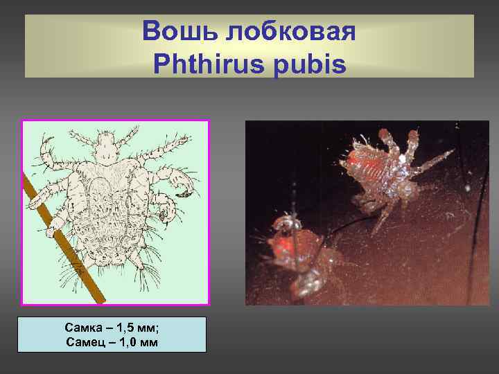 Вошь лобковая Phthirus pubis Самка – 1, 5 мм; Самец – 1, 0 мм