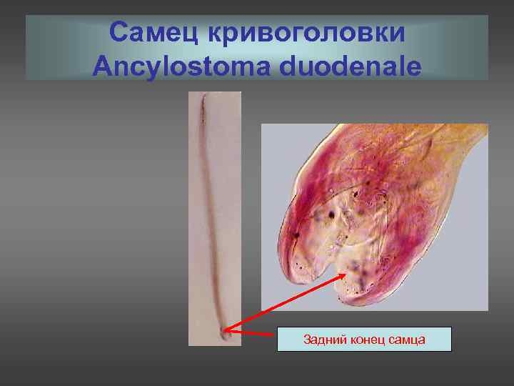 Самец кривоголовки Ancylostoma duodenale Задний конец самца 