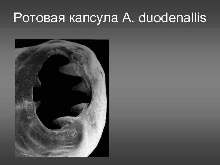 Ротовая капсула А. duodenallis 