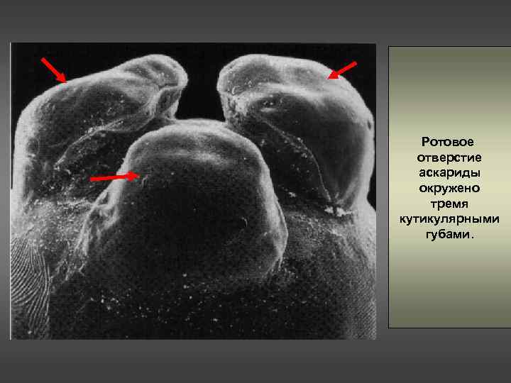Ротовое отверстие аскариды окружено тремя кутикулярными губами. 
