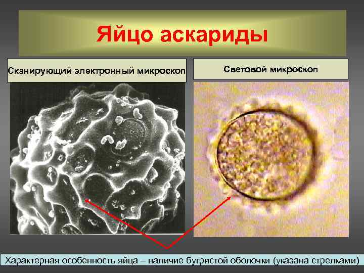 Аскарида яйца фото под микроскопом