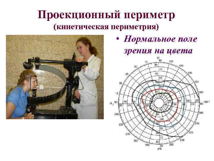 Периметрия в офтальмологии