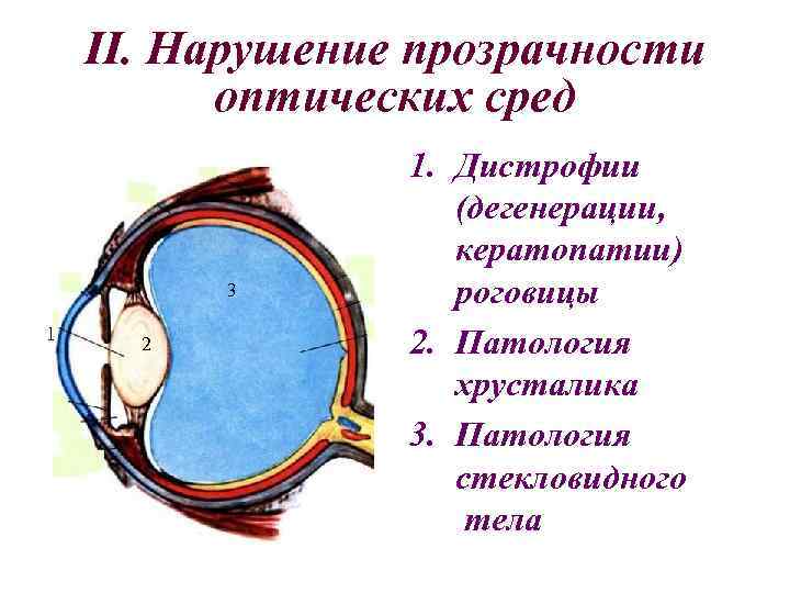 Перечислите оптические среды глаза. Дистрофии (дегенерации, кератопатии) роговицы. Непрозрачными оптическими средам это. Оптические среды прозрачные.