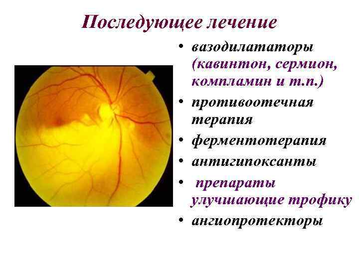 Последующее лечение • вазодилататоры (кавинтон, сермион, компламин и т. п. ) • противоотечная терапия