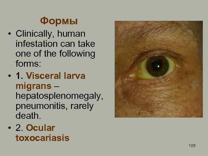 Формы • Clinically, human infestation can take one of the following forms: • 1.