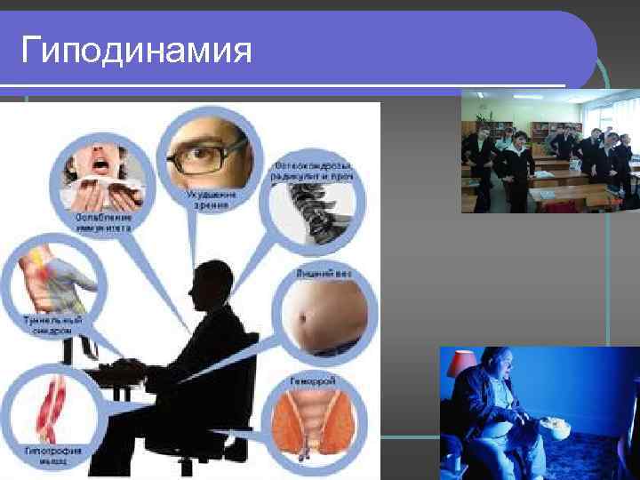 Гиподинамия 