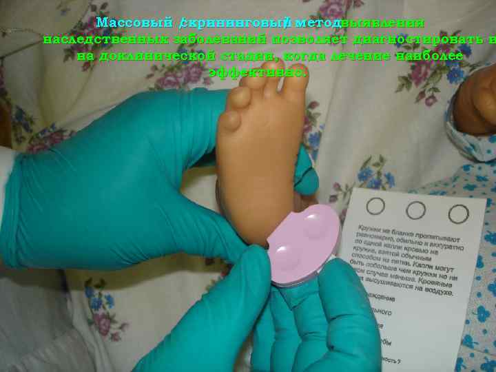 Массовый / скрининговый методвыявления / наследственных заболеваний позволяет диагностировать и на доклинической стадии, когда