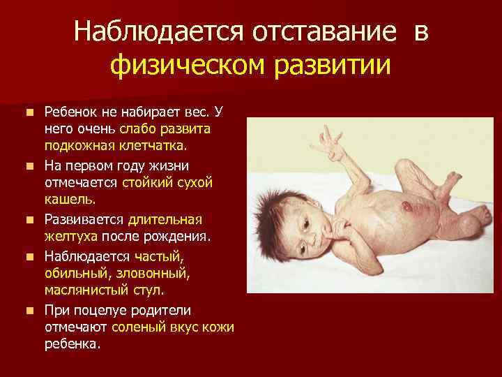 Наблюдается отставание в физическом развитии n n n Ребенок не набирает вес. У него
