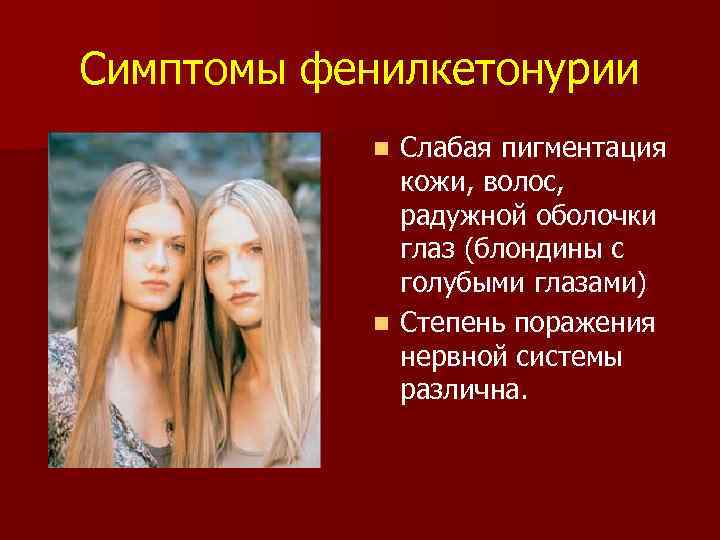 Симптомы фенилкетонурии Слабая пигментация кожи, волос, радужной оболочки глаз (блондины с голубыми глазами) n