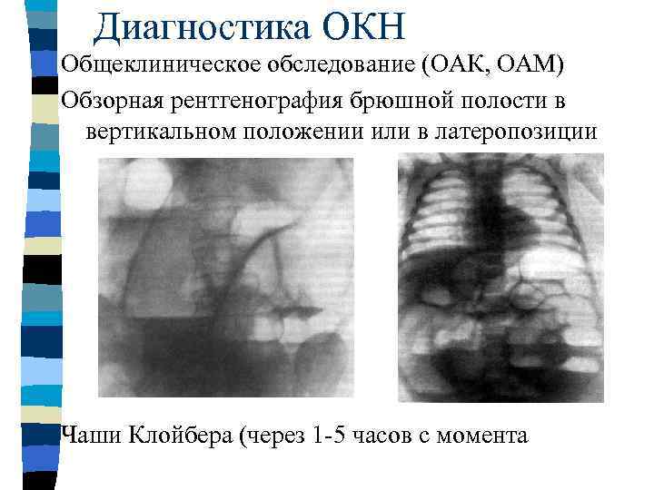 Острая артериальная непроходимость презентация хирургия