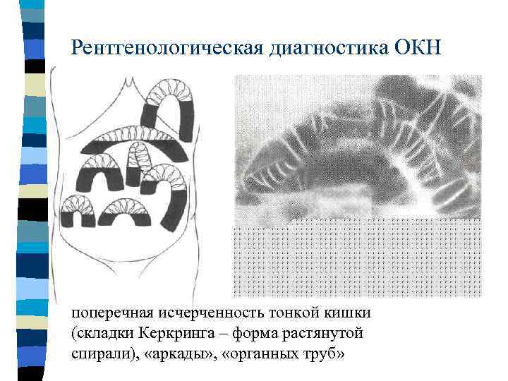 Окн хирургия презентация