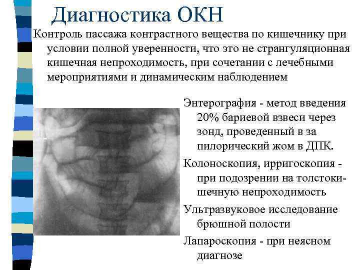 Острая кишечная непроходимость госпитальная хирургия презентация