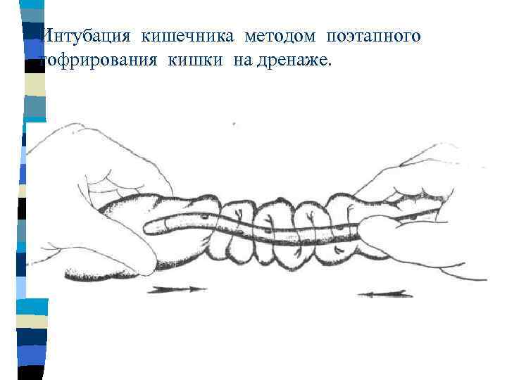 Исследование кишечника способы