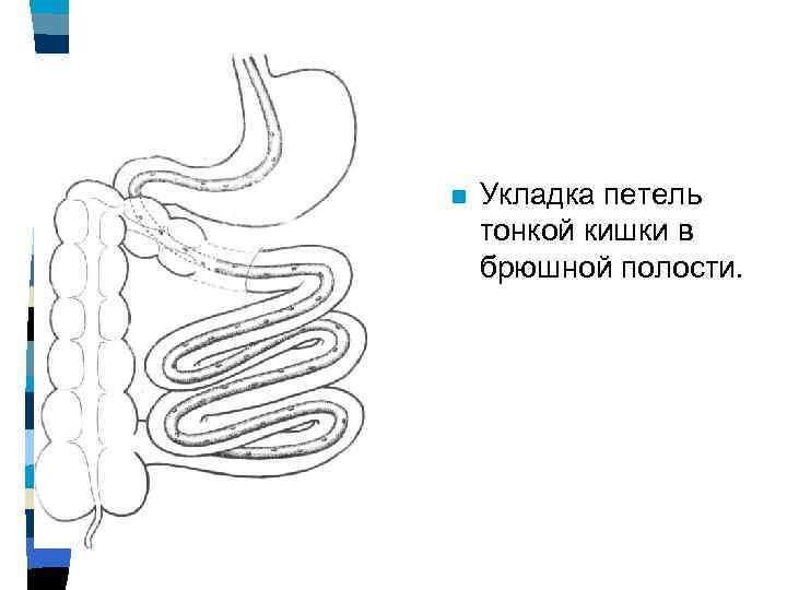 Расширение петель кишечника. Петли Толстого кишечника. Расположение петель тонкого кишечника. Раздутая петля кишечника.
