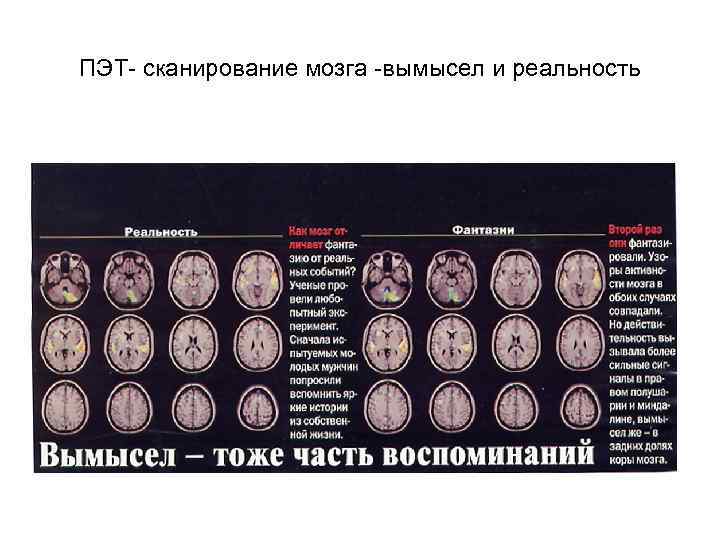ПЭТ- сканирование мозга -вымысел и реальность 