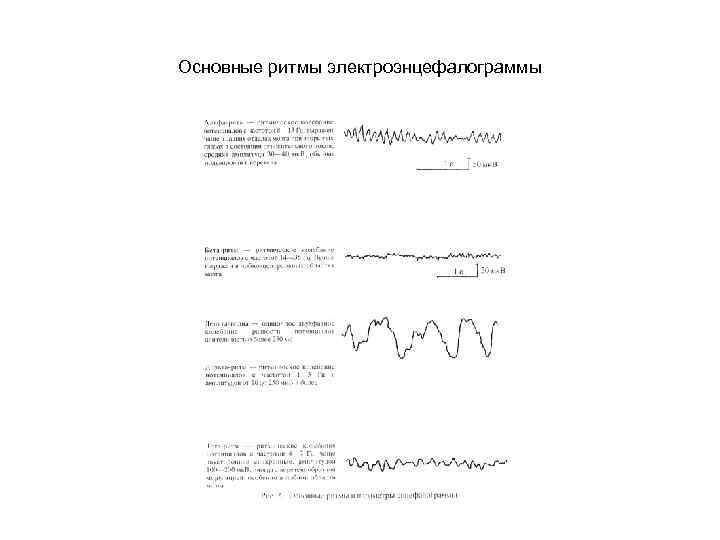 Основные ритмы электроэнцефалограммы 