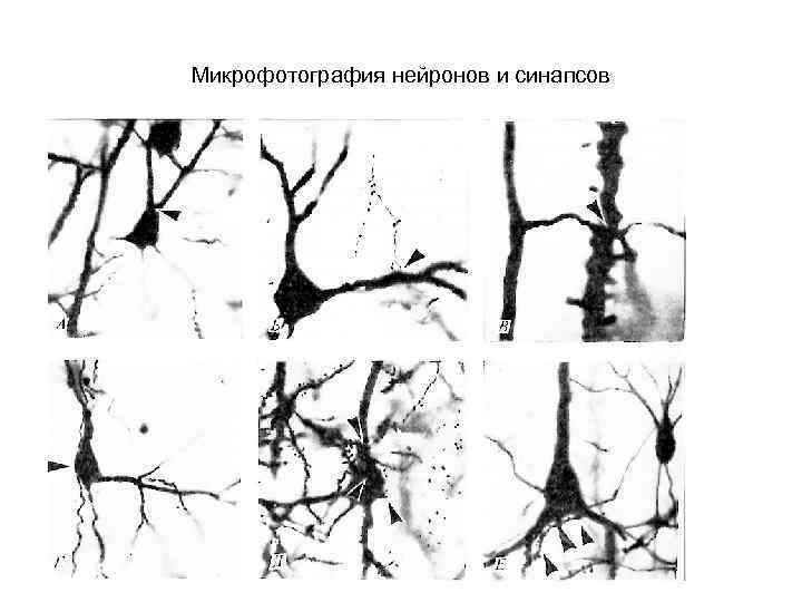 Микрофотография нейронов и синапсов 