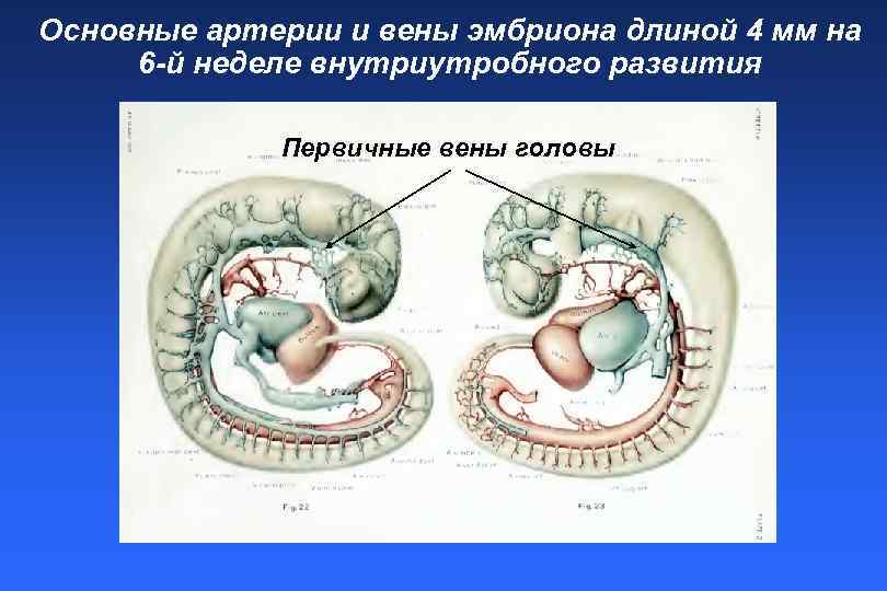 Внутриутробное поражение цнс