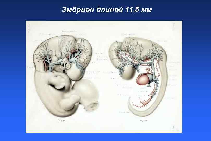 Эмбрион длиной 11, 5 мм 
