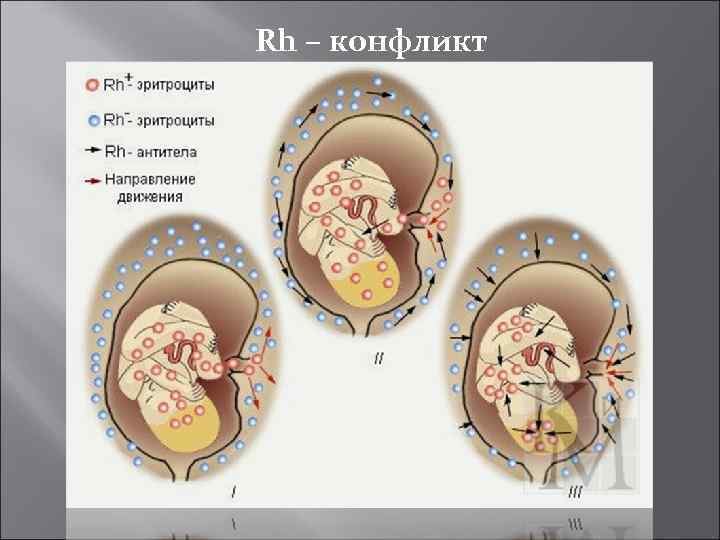 Rh – конфликт 