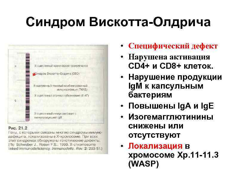 Синдром Вискотта-Олдрича ** * • Специфический дефект • Нарушена активация CD 4+ и CD