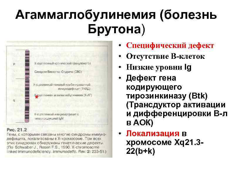 Агаммаглобулинемия (болезнь Брутона) • • * Специфический дефект Отсутствие В-клеток Низкие уровни Ig Дефект