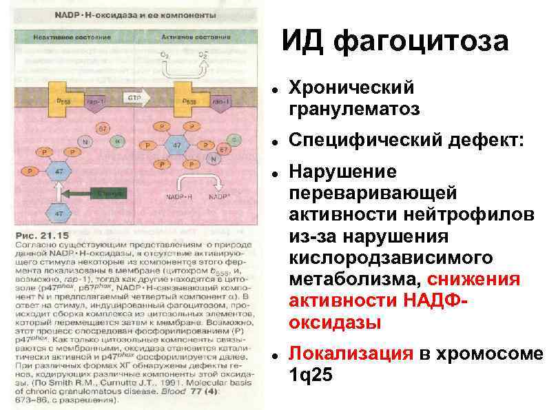 ИД фагоцитоза Хронический гранулематоз Специфический дефект: Нарушение переваривающей активности нейтрофилов из-за нарушения кислородзависимого метаболизма,