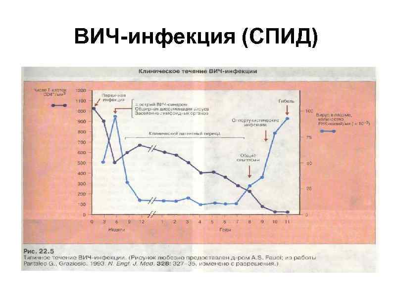 ВИЧ-инфекция (СПИД) 