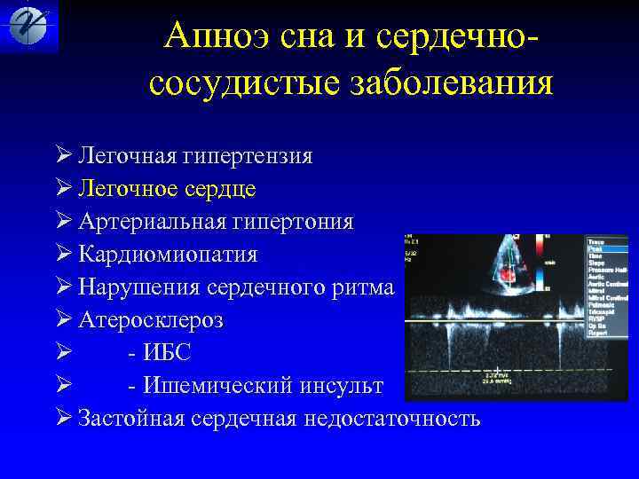  Апноэ сна и сердечно- сосудистые заболевания Ø Легочная гипертензия Ø Легочное сердце Ø