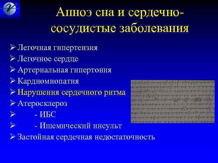  Апноэ сна и сердечно- сосудистые заболевания Ø Легочная гипертензия Ø Легочное сердце Ø