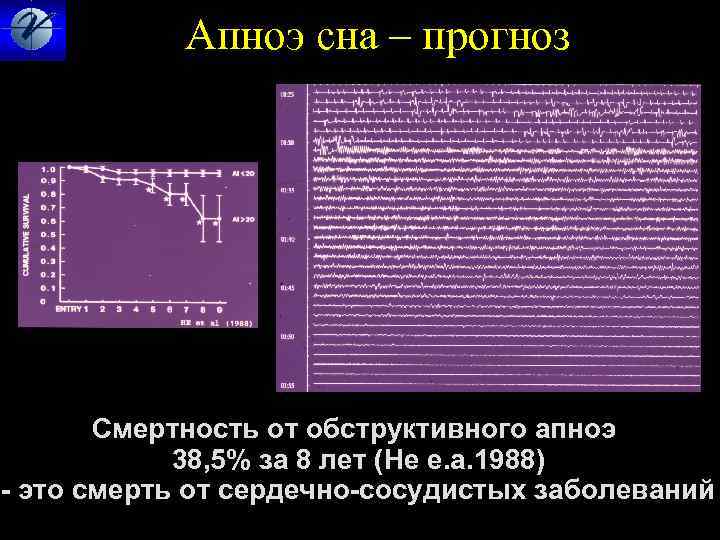  Апноэ сна – прогноз Смертность от обструктивного апноэ 38, 5% за 8 лет