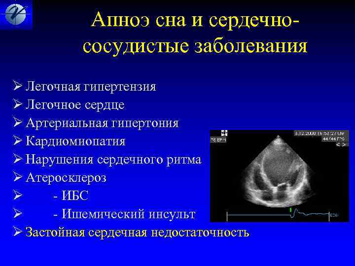  Апноэ сна и сердечно- сосудистые заболевания Ø Легочная гипертензия Ø Легочное сердце Ø