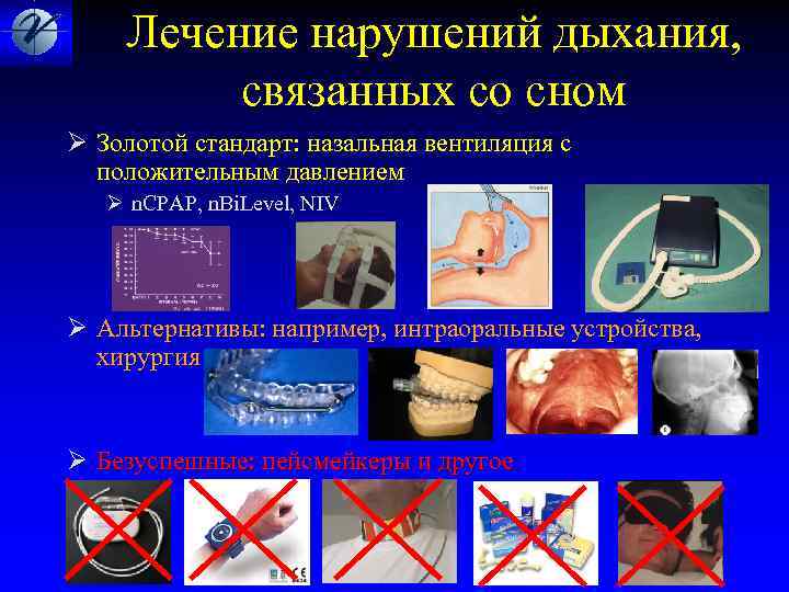  Лечение нарушений дыхания, связанных со сном Ø Золотой стандарт: назальная вентиляция с положительным