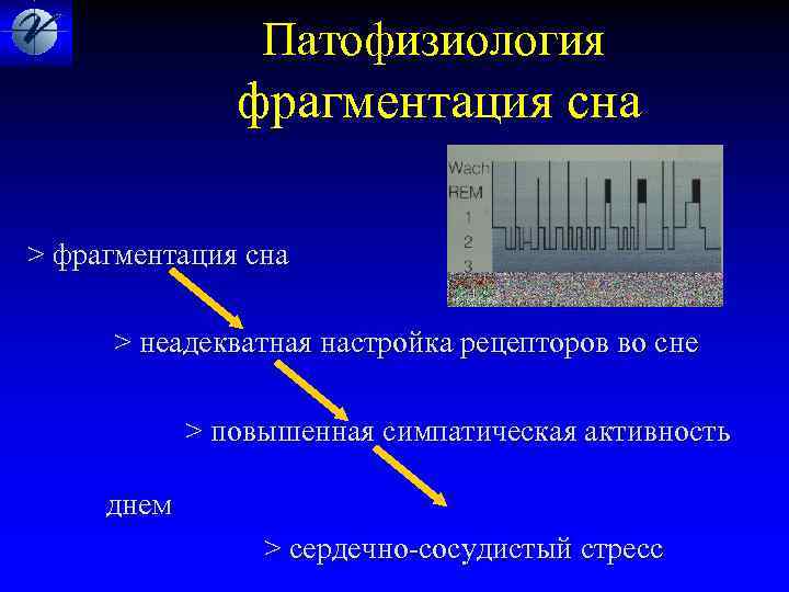  Патофизиология фрагментация сна > фрагментация сна > неaдeквaтная настpoйкa рецe. Птoрoв вo снe