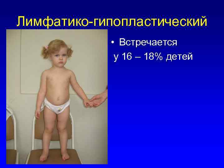Лимфатико-гипопластический • Встречается у 16 – 18% детей 
