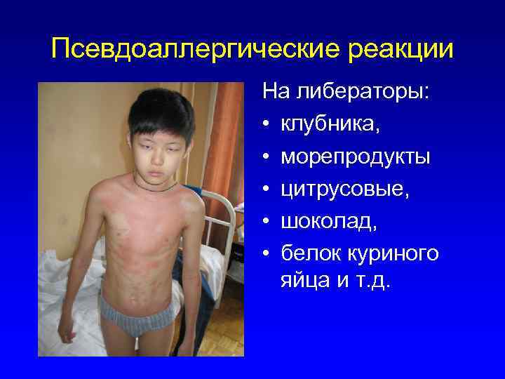 Псевдоаллергические реакции На либераторы: • клубника, • морепродукты • цитрусовые, • шоколад, • белок