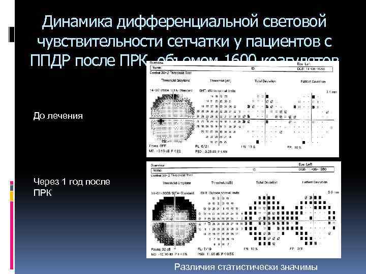 Динамика дифференциальной световой чувствительности сетчатки у пациентов с ППДР после ПРК объемом 1600 коагулятов