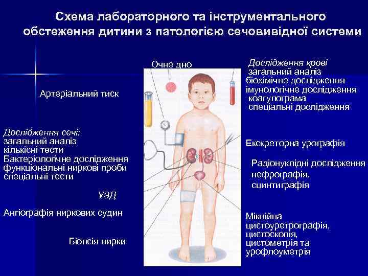 Схема лабораторного та інструментального обстеження дитини з патологією сечовивідної системи Очне дно Артеріальний тиск