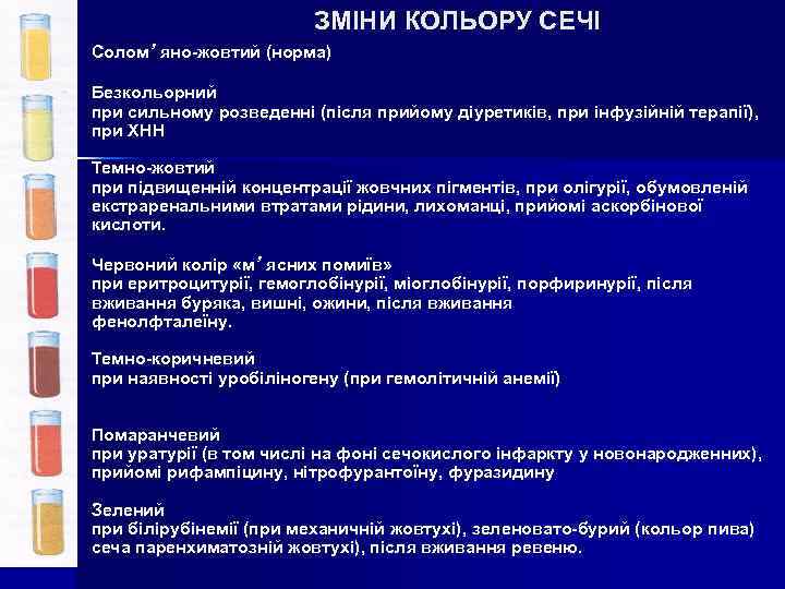 ЗМІНИ КОЛЬОРУ СЕЧІ Солом’ яно-жовтий (норма) Безкольорний при сильному розведенні (після прийому діуретиків, при