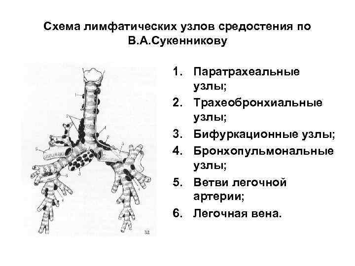 Схема лимфатических узлов средостения по В. А. Сукенникову 1. Паратрахеальные узлы; 2. Трахеобронхиальные узлы;