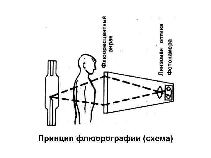 Принцип флюорографии (схема) 