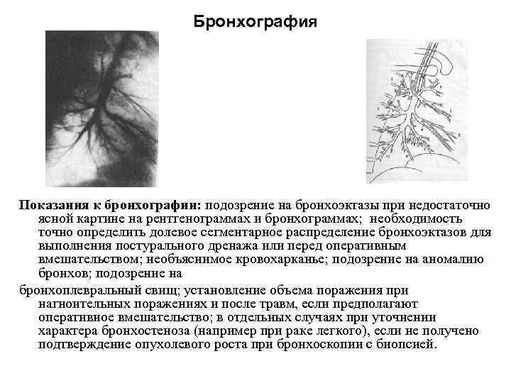 Бронхография Показания к бронхографии: подозрение на бронхоэктазы при недостаточно ясной картине на рентгенограммах и
