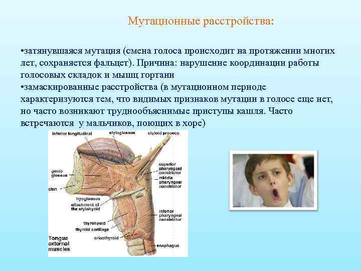 Мутационные расстройства: • затянувшаяся мутация (смена голоса происходит на протяжении многих лет, сохраняется фальцет).