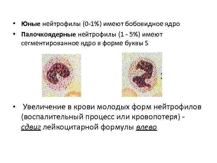  • Юные нейтрофилы (0 -1%) имеют бобовидное ядро • Палочкоядерные нейтрофилы (1 -