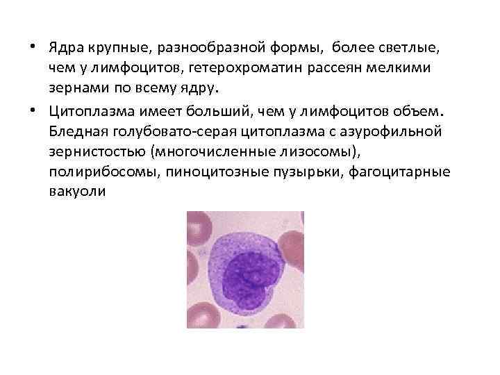  • Ядра крупные, разнообразной формы, более светлые, чем у лимфоцитов, гетерохроматин рассеян мелкими