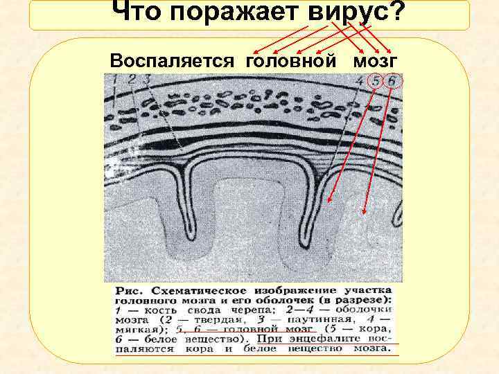 Что поражает вирус? Воспаляется головной мозг 