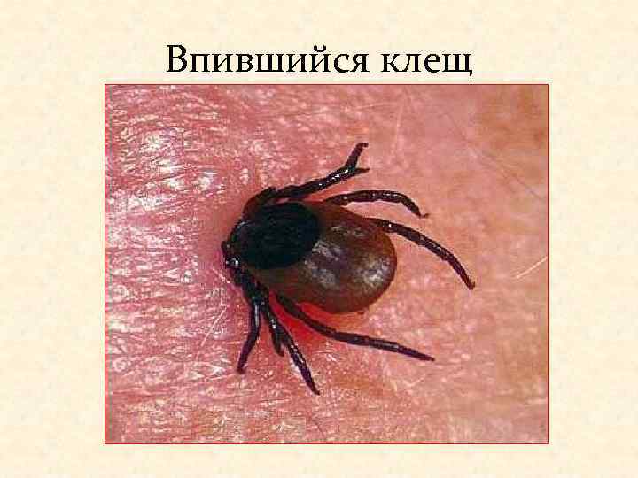 Впившийся клещ 